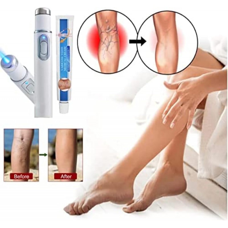 Crème De Traitement des Varices Venoheal, Traitement des Varices pour Les Jambes, Stylo De Traitement des Varices, Stylo De